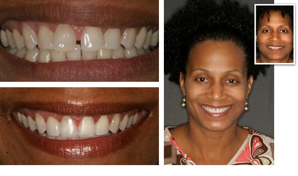 patient dental treatment results